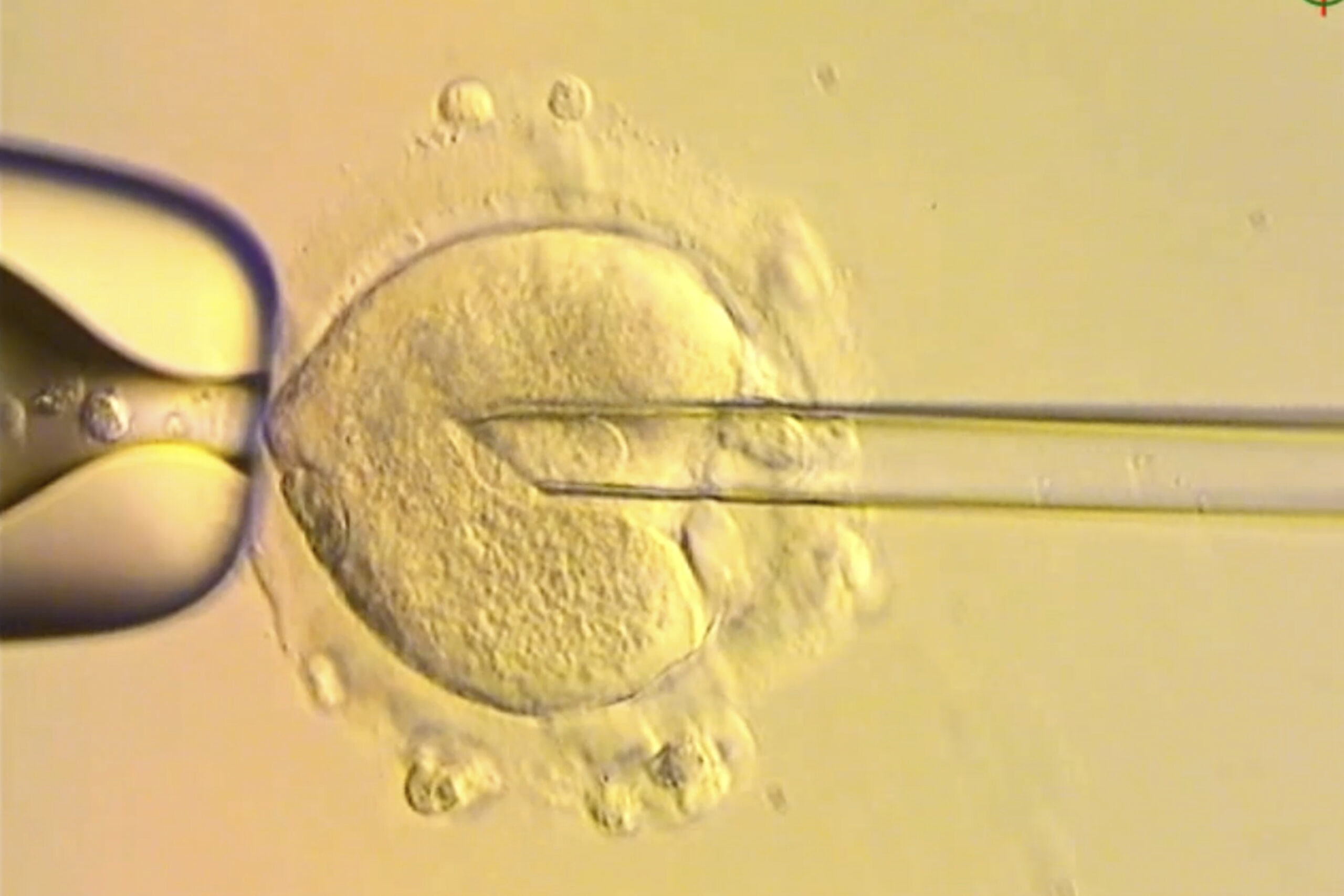 The Embryo Nobody Conceived, and the Law That Never Saw It Coming